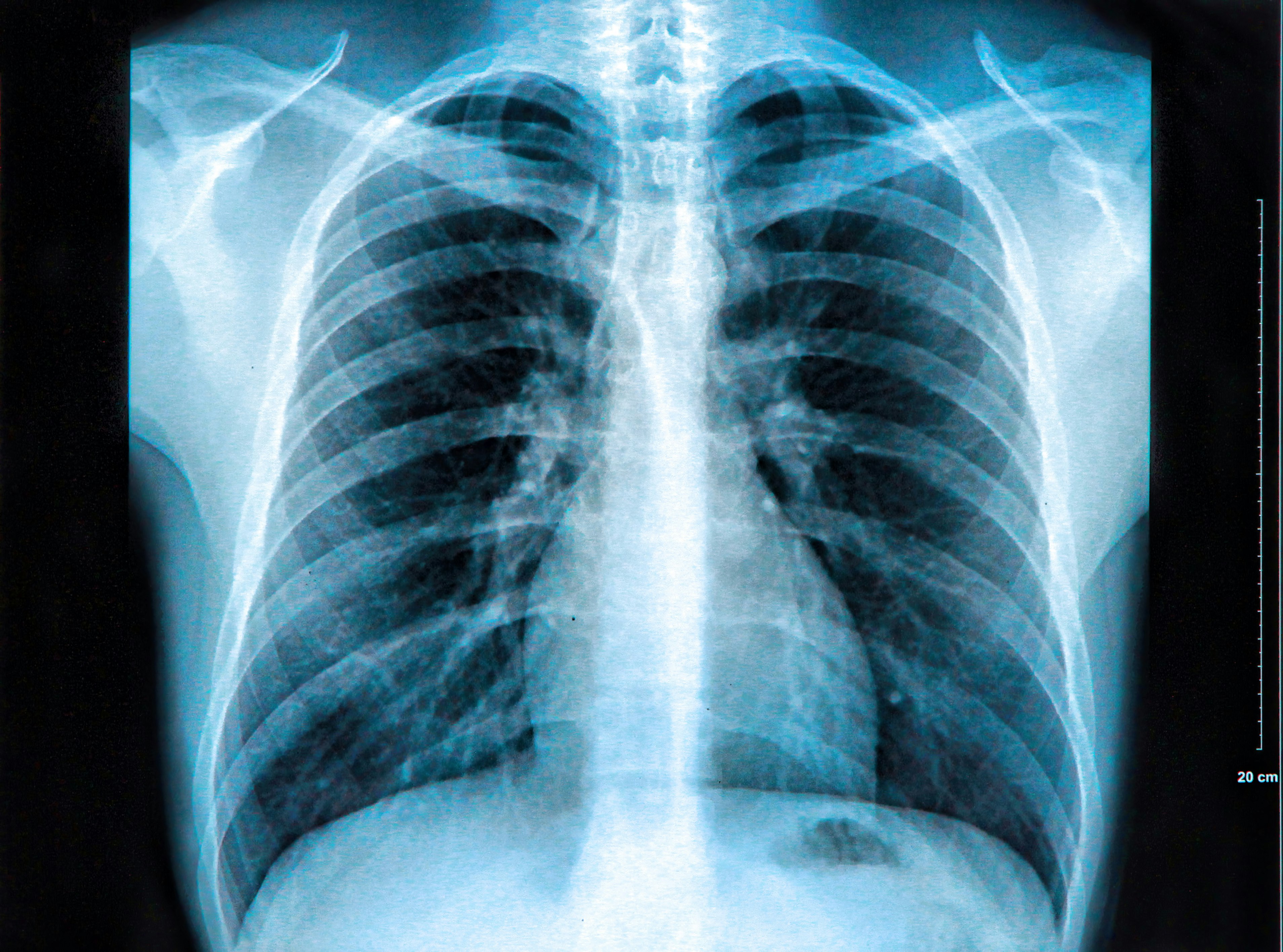 The Science Behind X-Ray Imaging