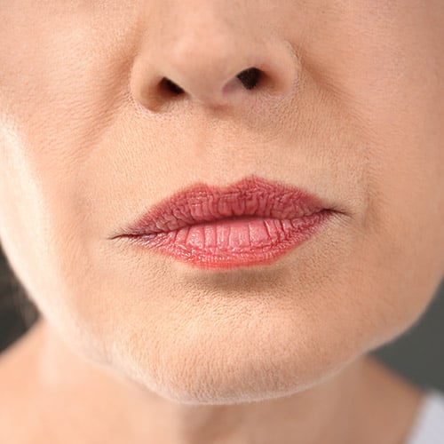 Mature Lips: How to Treat Them