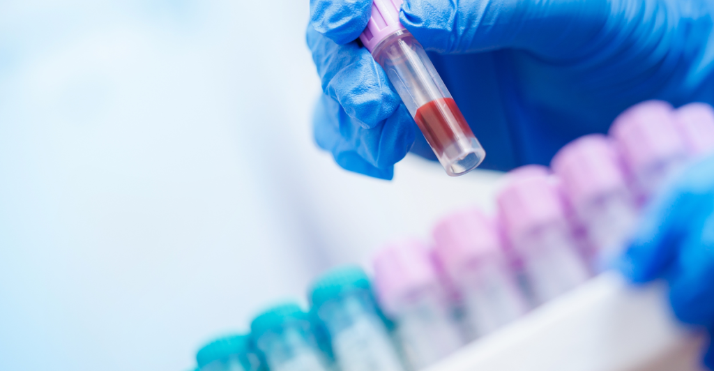 fleury-serotonina-tecnologia