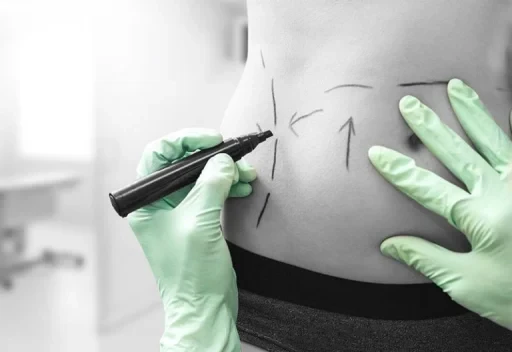 Minimally invasive surgery