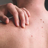 Skin quality & skin condition